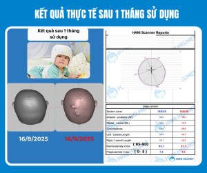 Kết quả can thiệp thực tế