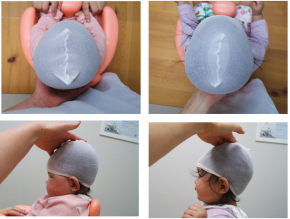 Hiệu quả lâm sàng đã được chứng minh