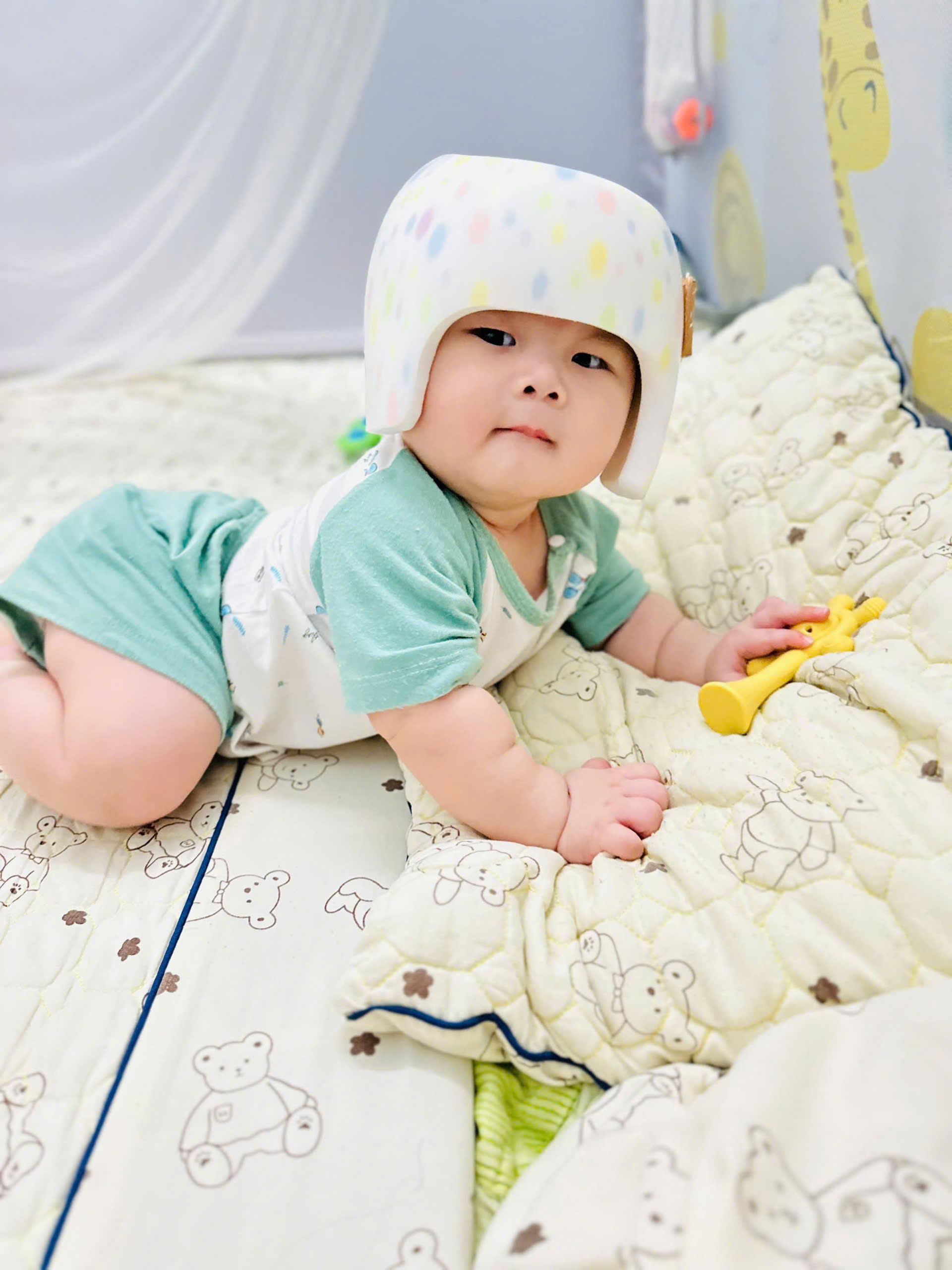 Ảnh hưởng của biến dạng hộp sọ đến sự phát triển của trẻ