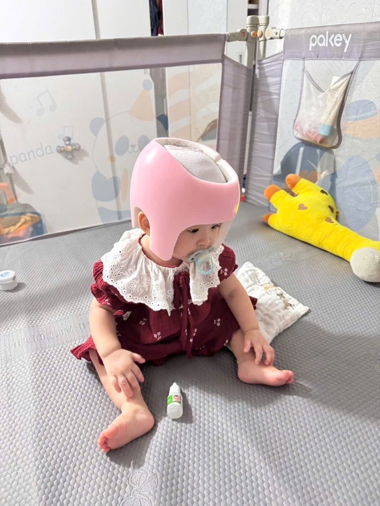 Bé thoải mái khi sử dụng mũ chỉnh hình