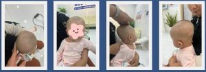 Cách quan sát đầu bé tại nhà