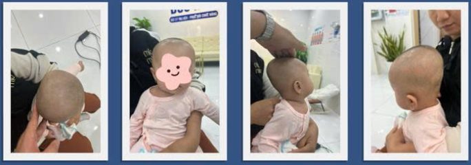 Cách quan sát đầu bé tại nhà 